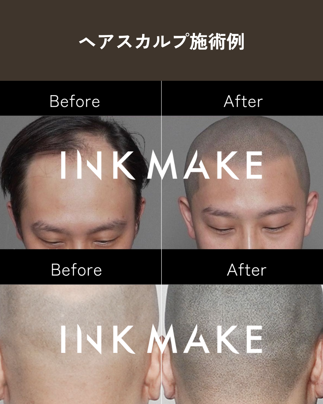 【大阪③】ヘアスカルプ・インクメイク講習受講費／2026年10月28日(水)