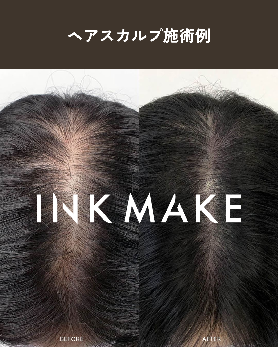 【大阪③】ヘアスカルプ・インクメイク講習受講費／2026年10月28日(水)