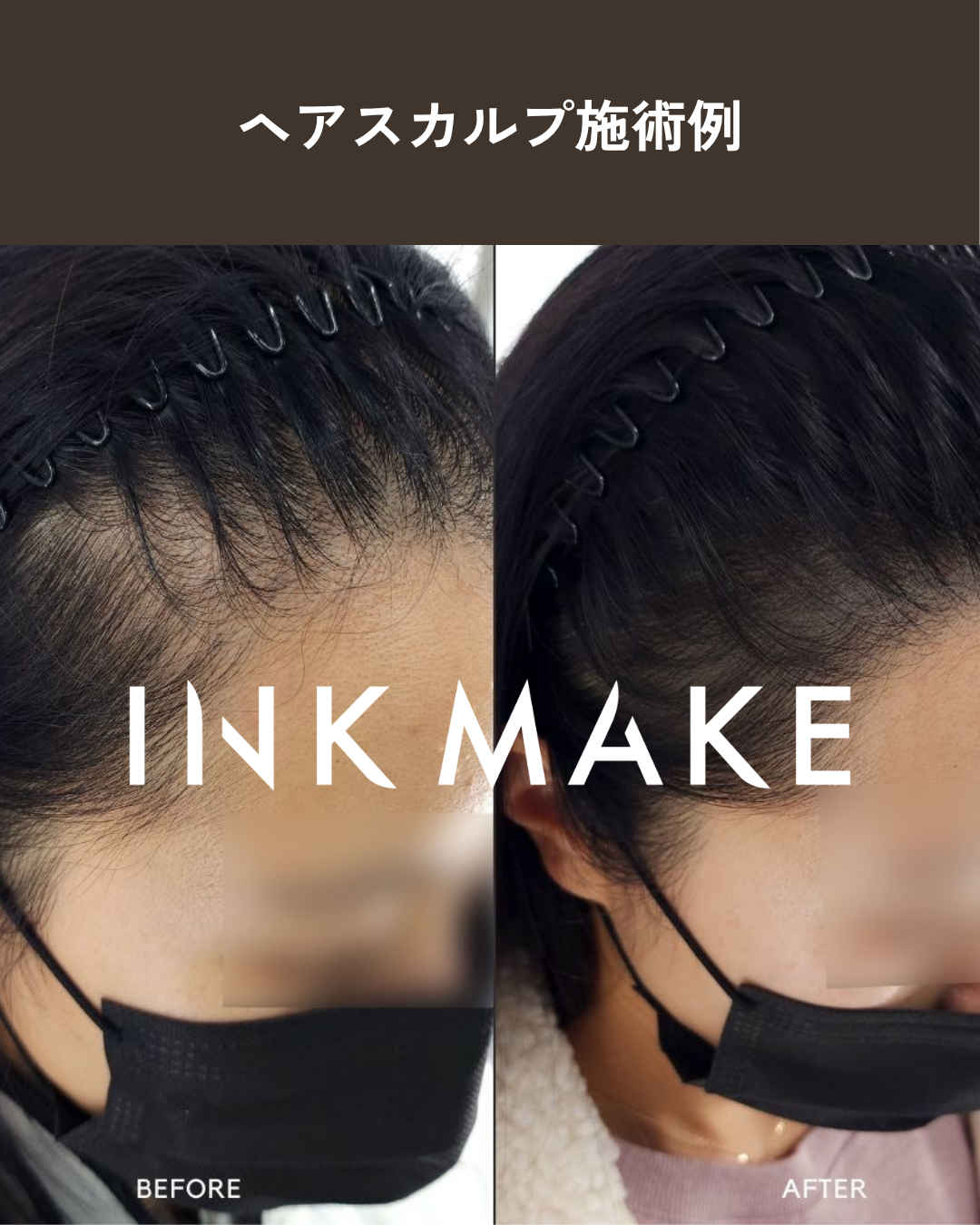【大阪③】ヘアスカルプ・インクメイク講習受講費／2026年10月28日(水)