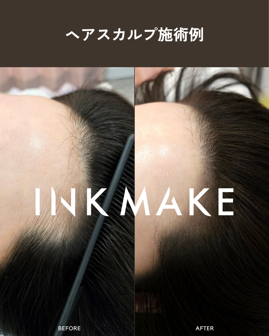 【大阪③】ヘアスカルプ・インクメイク講習受講費／2026年10月28日(水)