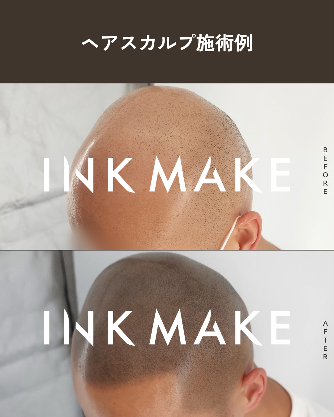 【大阪③】ヘアスカルプ・インクメイク講習受講費／2026年10月28日(水)