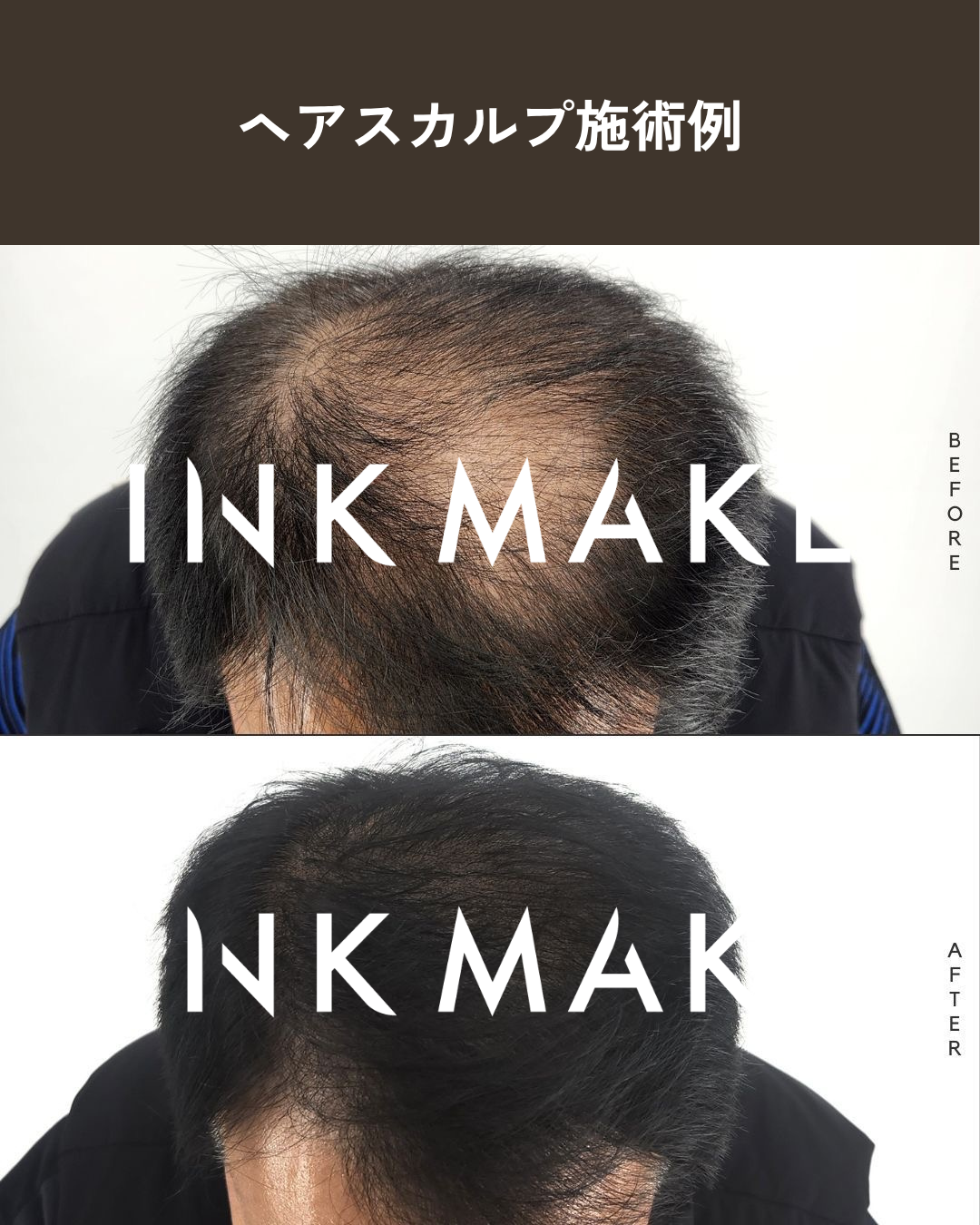 【大阪③】ヘアスカルプ・インクメイク講習受講費／2026年10月28日(水)